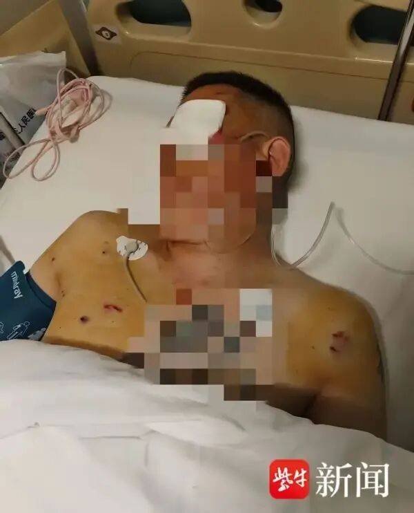 丹佛掘金 vs 达拉斯独行侠
_男子取170万元现金银行门口遭抢丹佛掘金 vs 达拉斯独行侠
,工作人员无动于衷